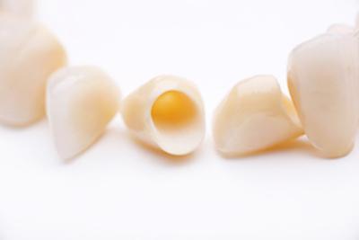 Close up of dental crowns in Springfield IL