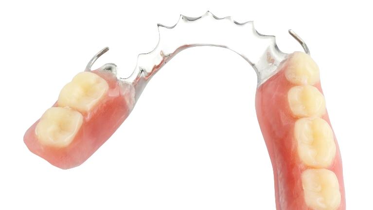 image of Dentures | Springfield IL