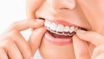 picture of a lady putting on invisalign clear braces