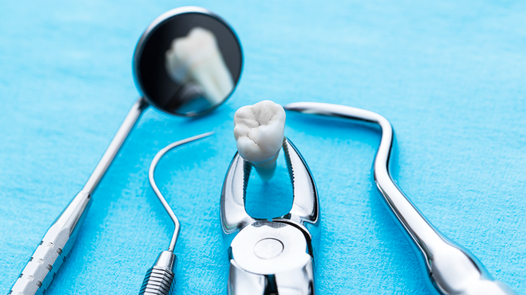 Tools used for tooth extraction at Springfield dental office