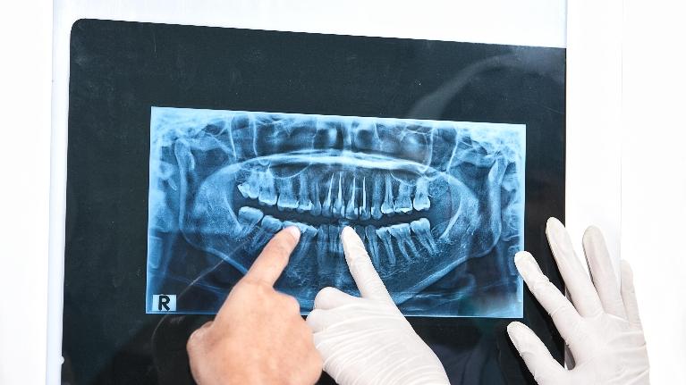 Springfield IL dentist near me looking at x-ray of teeth