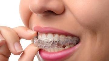 woman putting in clear plastic aligner | invisalign springfield il