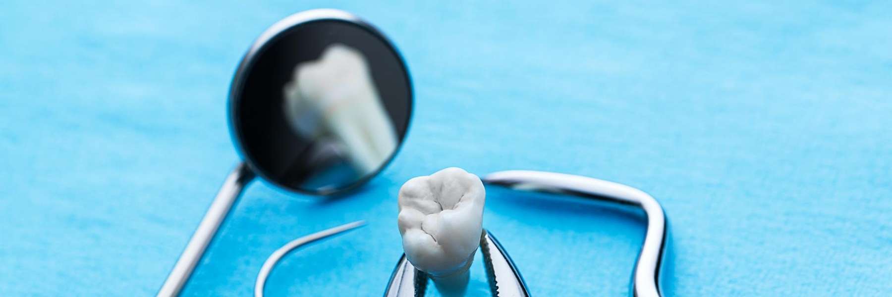 tooth extraction in Springfield, IL