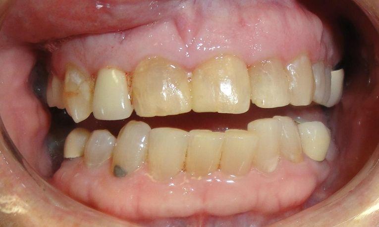 Close up of smile with discolored teeth at Ruggless Dental